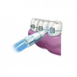 Ugello ortodontico WP-160/300/450/02